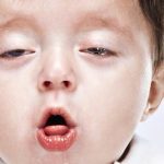 Phòng và trị viêm họng dạng nhẹ cho trẻ đúng cách